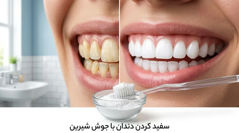 سفید کردن دندان با جوش شیرین امکان پذیر است؟ مزایا، روش صحیح